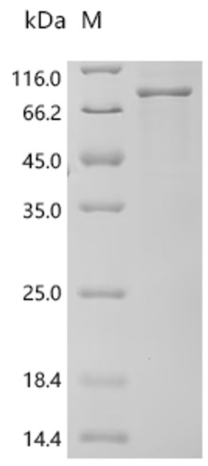 Recombinant Human RAF proto-oncogene serine/threonine-protein kinase (RAF1) (CSB-EP019284HUc7)
