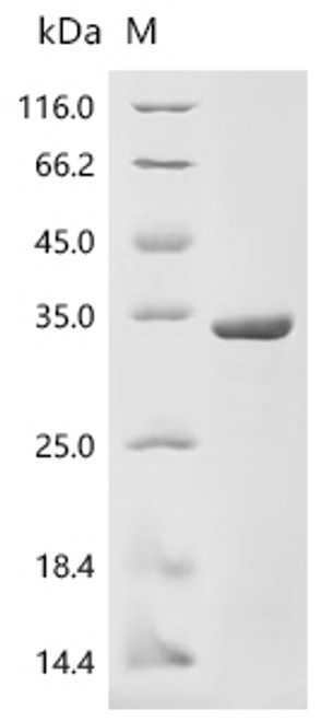 Recombinant Human Deoxyribonuclease-1 (DNASE1) (CSB-EP007049HU)