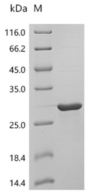 Recombinant Human Lipocalin-1 (LCN1) (CSB-EP012810HU)