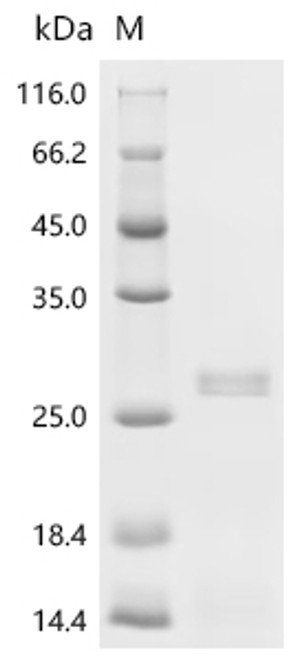 Recombinant Human Granulocyte-macrophage colony-stimulating factor (CSF2) (CSB-EP006045HUa0)