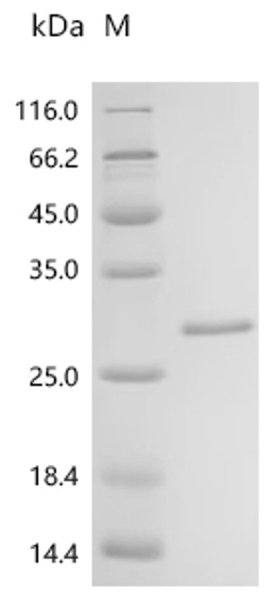 Recombinant Streptococcus agalactiae serotype III Single-stranded DNA-binding protein 1 (ssb1) (CSB-EP354227SMH)