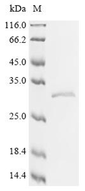 Recombinant Human ADP/ATP translocase 1 (SLC25A4) (CSB-CF021510HU)