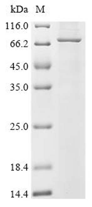 Recombinant Human Mannosyl-oligosaccharide 1,2-alpha-mannosidase IB (MAN1A2) (CSB-CF013384HU)
