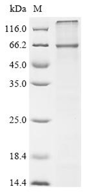 Recombinant Human Transmembrane 9 superfamily member 1 (TM9SF1) (CSB-CF023626HU(A4))