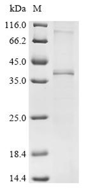 Recombinant Macaca mulatta Gonadotropin-releasing hormone II receptor (GNRHR2) (CSB-CF856800MOW)