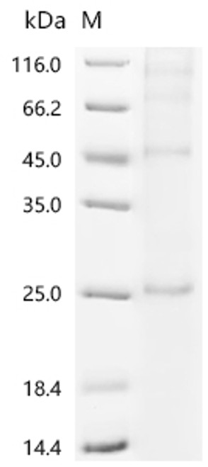 Recombinant Human 3-oxo-5-alpha-steroid 4-dehydrogenase 2 (SRD5A2) (CSB-CF022654HU)