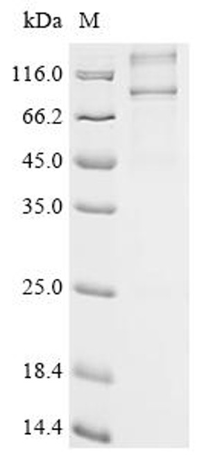 Recombinant Plasmodium falciparum Rhomboid-like protease (PF3D7_0506900) (CSB-CF5410EWP)