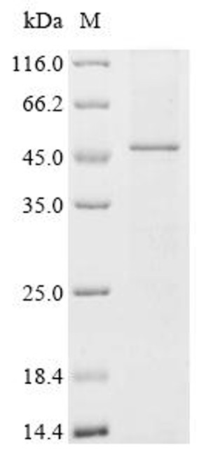 Recombinant Human Protein-serine O-palmitoleoyltransferase porcupine (PORCN) (CSB-CF887958HU(A4))