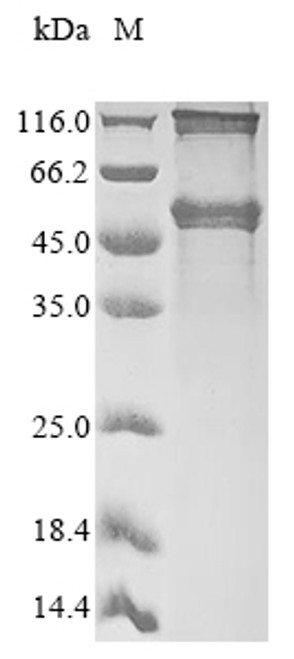 Recombinant Mouse Necdin (Ndn) (CSB-CF015606MO)