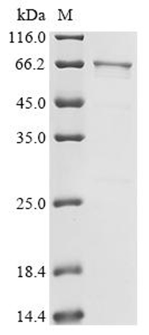 Recombinant Human Heterogeneous nuclear ribonucleoprotein K (HNRNPK), partial (CSB-EP010611HU1)