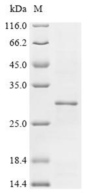 Recombinant Escherichia coli Ferrichrome outer membrane transporter/phage receptor (fhuA), partial (CSB-EP362005ENV)