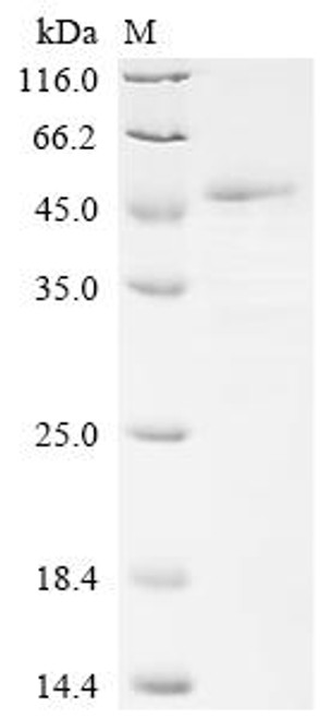 Recombinant Human Collagen alpha-1 (I) chain (COL1A1), partial (CSB-YP005727HU)