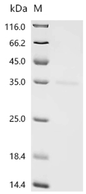 Recombinant Human Survival motor neuron protein (SMN1), partial (CSB-YP614982HU)