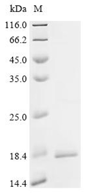 Recombinant Streptococcus agalactiae serotype V Nucleoside diphosphate kinase (ndk) (CSB-YP810997SMI)