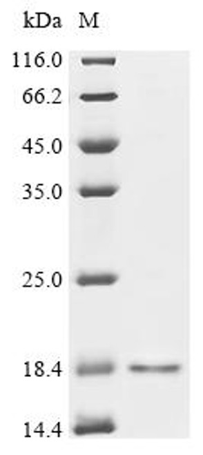 Recombinant Macaca fascicularis Hemoglobin subunit beta (HBB) (CSB-YP010150MOV)