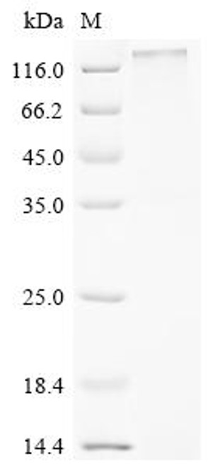 Recombinant Human Seizure 6-like protein (SEZ6L), partial (CSB-YP871613HU1)