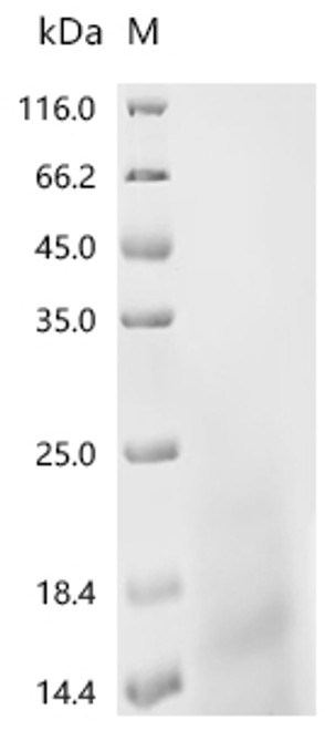 Recombinant Escherichia coli O6:H1 DNA-binding protein HU-alpha (hupA) (CSB-YP364791FQR) Recombinant Escherichia coli O6:H1 DNA-binding protein HU-alpha (hupA) (CSB-YP364791FQR)