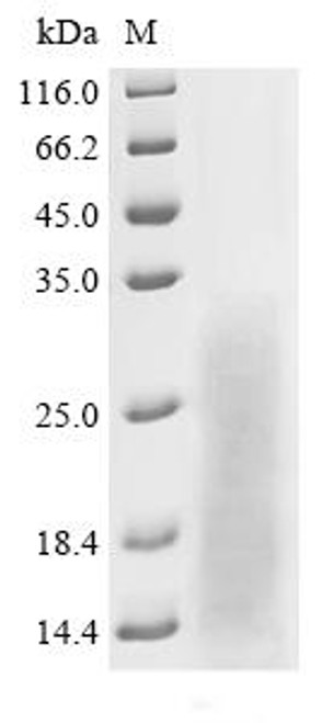 Recombinant Macrovipera lebetina Chymotrypsin-like protease VLCTLP (CSB-YP522192MPJ)