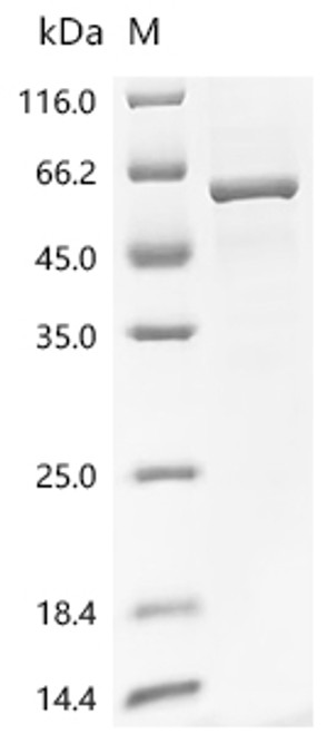 Recombinant Human Glucose-6-phosphate 1-dehydrogenase (G6PD) (CSB-YP009121HU)