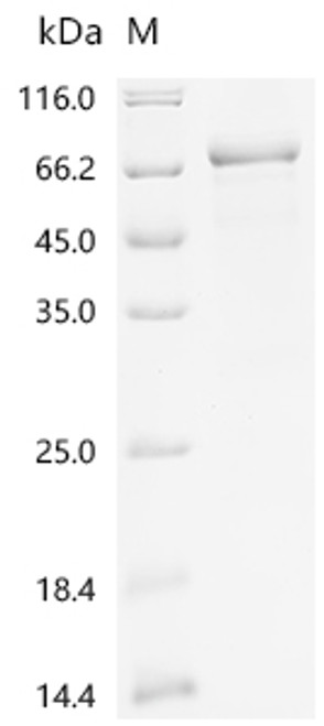 Recombinant Mouse Na (+)/H (+) exchange regulatory cofactor NHE-RF3 (Pdzk1) (CSB-YP862368MO)