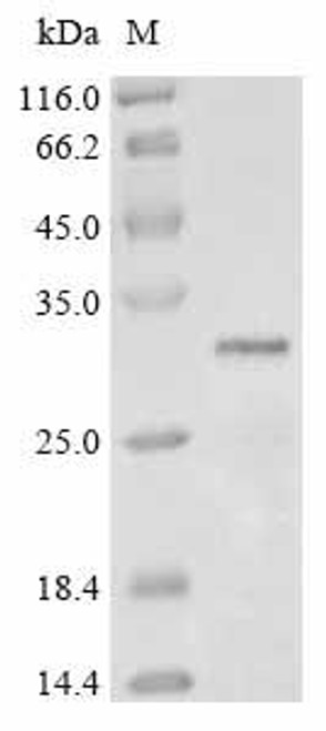 Recombinant Pantoea stewartii subsp. stewartii Transcriptional activator protein esaR (esaR) (CSB-YP347483EGK)