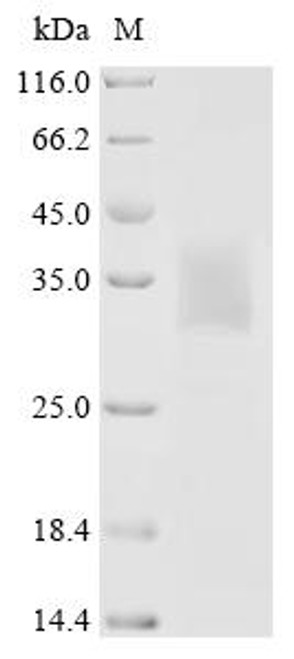 Recombinant Human Stimulator of interferon genes protein (STING1), partial (CSB-YP023754HU1c7)