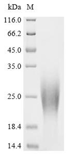 Recombinant Mouse Cytochrome c oxidase subunit 4 isoform 1, mitochondrial (Cox4i1), partial (CSB-YP005832MO1) Recombinant Mouse Cytochrome c oxidase subunit 4 isoform 1, mitochondrial (Cox4i1), partial (CSB-YP005832MO1)