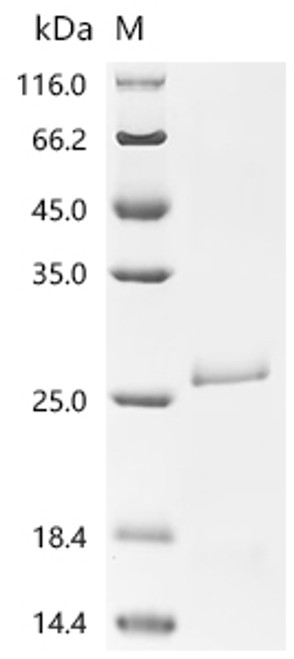 Recombinant Human Ras-related C3 botulinum toxin substrate 1 (RAC1) (CSB-YP019242HU)