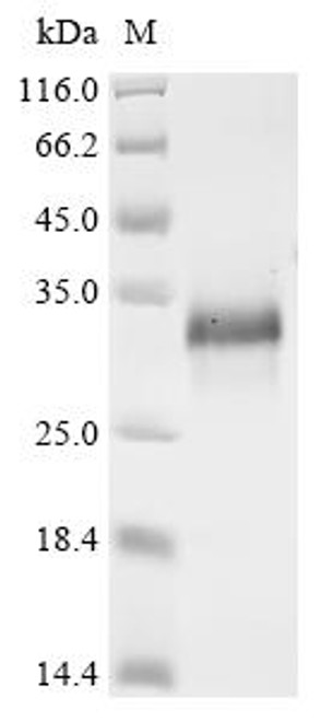 Recombinant Mouse Cornifin-A (Sprr1a) (CSB-YP720294MO) Recombinant Mouse Cornifin-A (Sprr1a) (CSB-YP720294MO)