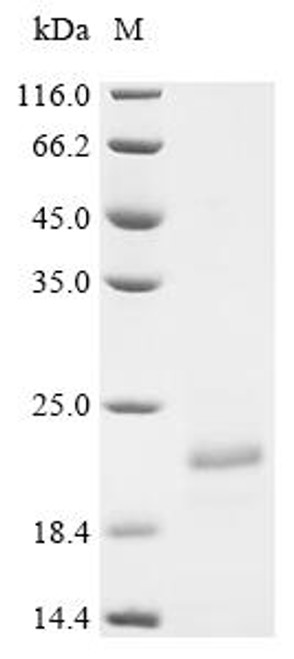 Recombinant Conus kinoshitai Mu-conotoxin KIIIB, partial (CSB-YP313491COP)