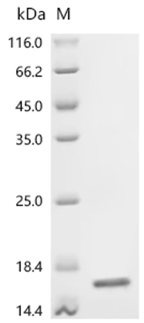 Recombinant Mouse Fatty acid-binding protein, adipocyte (Fabp4) (CSB-YP007945MO) Recombinant Mouse Fatty acid-binding protein, adipocyte (Fabp4) (CSB-YP007945MO)
