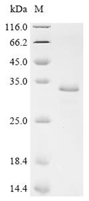 Recombinant Mycobacterium tuberculosis Protein grpE (grpE) (CSB-YP335761MVZ)
