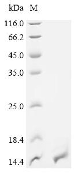 Recombinant Mycobacterium tuberculosis Meromycolate extension acyl carrier protein (acpM) (CSB-YP358590MVZ)