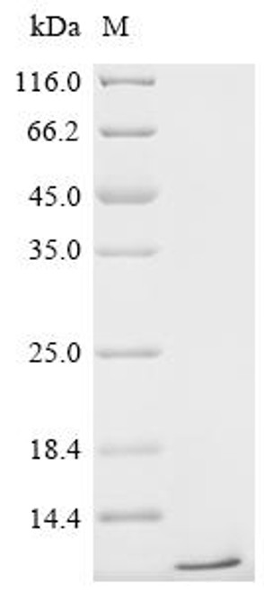 Recombinant Mycobacterium tuberculosis Metallothionein (mymT) (CSB-YP317655MVZ) Recombinant Mycobacterium tuberculosis Metallothionein (mymT) (CSB-YP317655MVZ)