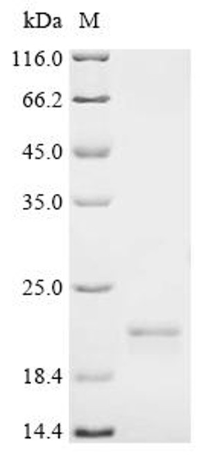 Recombinant Human Sorting nexin-12 (SNX12) (CSB-YP891787HU) Recombinant Human Sorting nexin-12 (SNX12) (CSB-YP891787HU)