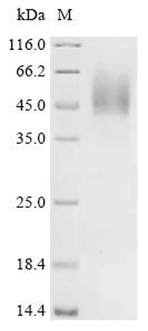 Recombinant Staphylococcus aureus Iron-regulated surface determinant protein H (isdH), partial (CSB-YP858191SKY) Recombinant Staphylococcus aureus Iron-regulated surface determinant protein H (isdH), partial (CSB-YP858191SKY)