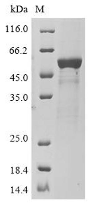 Recombinant Human Atrial natriuretic peptide receptor 2 (NPR2), partial (CSB-YP016024HU)