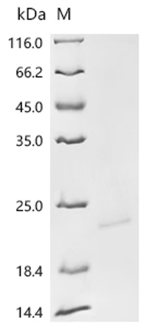 Recombinant Epstein-Barr virus Epstein-Barr nuclear antigen 1 (EBNA1), partial (CSB-YP365878EFA) Recombinant Epstein-Barr virus Epstein-Barr nuclear antigen 1 (EBNA1), partial (CSB-YP365878EFA)