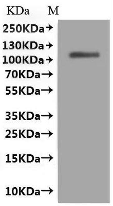 Recombinant Dog Folate hydrolase 1 (folh1), partial (CSB-MP5772DO) Recombinant Dog Folate hydrolase 1 (folh1), partial (CSB-MP5772DO)