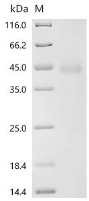 Recombinant Feline herpesvirus 1 Envelope glycoprotein B (UL27), partial (CSB-BP5721FAJ)