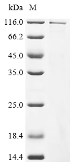 Recombinant Mouse Dapper homolog 1 (Dact1) (CSB-EP844457MOb1)