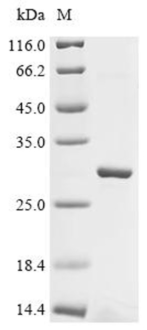 Recombinant Mouse Sorting nexin-32 (Snx32), partial (CSB-EP770506MO4) Recombinant Mouse Sorting nexin-32 (Snx32), partial (CSB-EP770506MO4)
