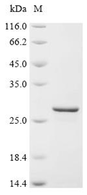 Recombinant Human Very-long-chain (3R)-3-hydroxyacyl-CoA dehydratase 3 (HACD3), partial (CSB-EP878945HU1) Recombinant Human Very-long-chain (3R)-3-hydroxyacyl-CoA dehydratase 3 (HACD3), partial (CSB-EP878945HU1)