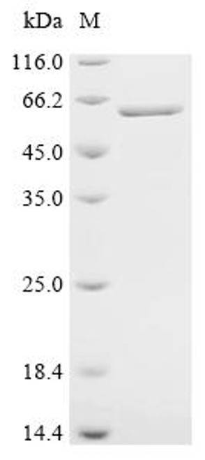Recombinant Mouse Tubulin beta-5 chain (Tubb5) (CSB-EP311427MO) Recombinant Mouse Tubulin beta-5 chain (Tubb5) (CSB-EP311427MO)