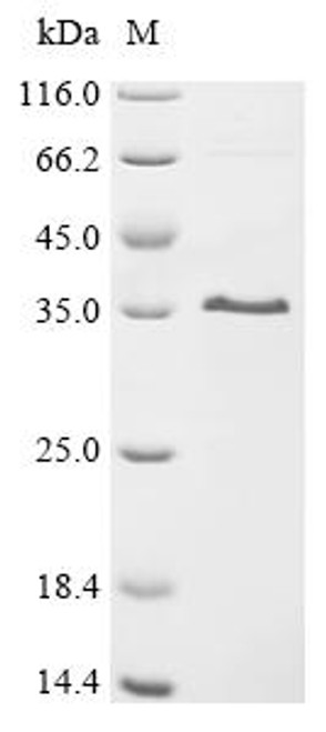 Recombinant Rat Matrix-remodeling-associated protein 7 (MXRA7), partial (CSB-EP5937RA1) Recombinant Rat Matrix-remodeling-associated protein 7 (MXRA7), partial (CSB-EP5937RA1)