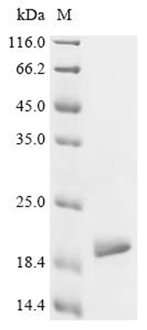 Recombinant Human Microtubule-associated protein tau (MAPT), partial (CSB-EP013481HU1(F8)) Recombinant Human Microtubule-associated protein tau (MAPT), partial (CSB-EP013481HU1(F8))