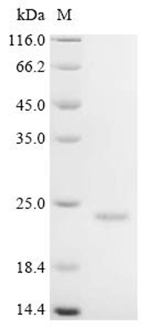 Recombinant Sheep Inter-alpha-trypsin inhibitor (CSB-EP351801SH) Recombinant Sheep Inter-alpha-trypsin inhibitor (CSB-EP351801SH)