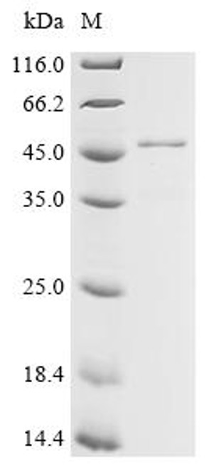 Recombinant Arabidopsis thaliana Chlorophyllase-1 (CLH1) (CSB-EP519505DOA) Recombinant Arabidopsis thaliana Chlorophyllase-1 (CLH1) (CSB-EP519505DOA)