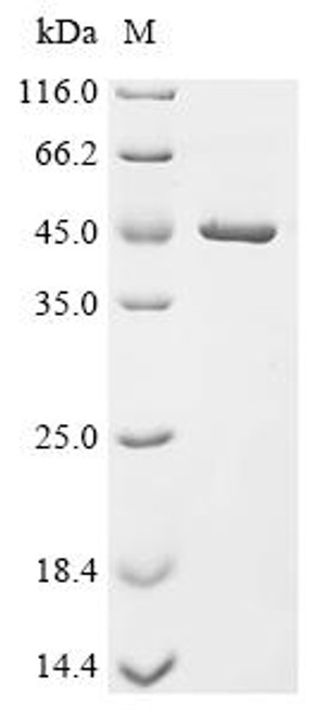Recombinant Enterobacteria phage T4 RNA ligase 2 (Y10A) (CSB-EP327123EDZ) Recombinant Enterobacteria phage T4 RNA ligase 2 (Y10A) (CSB-EP327123EDZ)