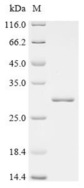 Recombinant Human Protein IWS1 homolog (IWS1), partial (CSB-EP822304HU) Recombinant Human Protein IWS1 homolog (IWS1), partial (CSB-EP822304HU)